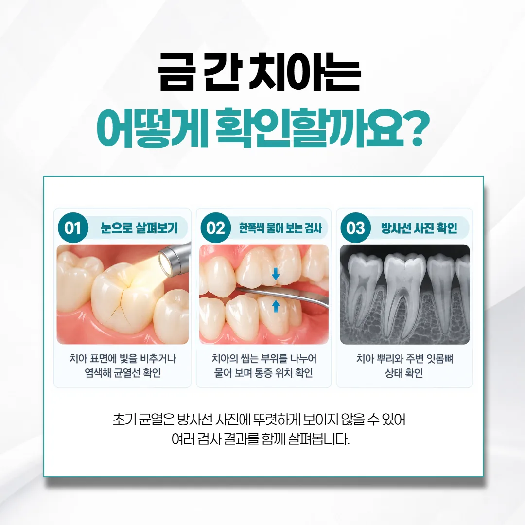 금 간 치아를 찾는 눈으로 살펴보기와 물어 보는 검사와 방사선 사진 세 칸 카드