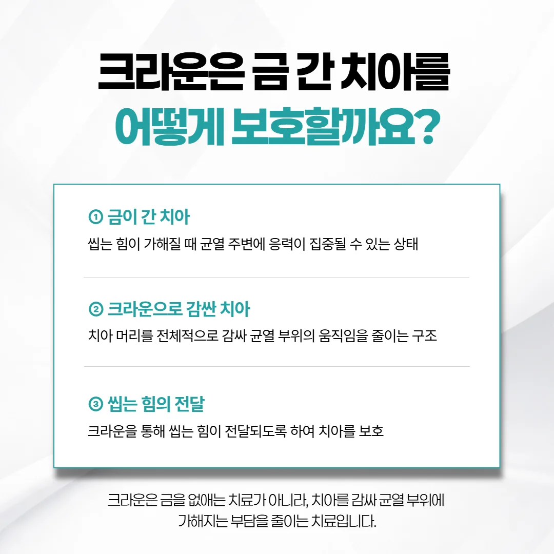 크라운이 금 간 치아를 감싸 씹는 힘을 치아 전체로 나누는 원리 도식